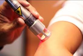 LASERTERAPIA